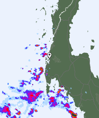 Radar