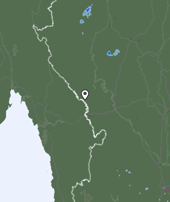 Radar