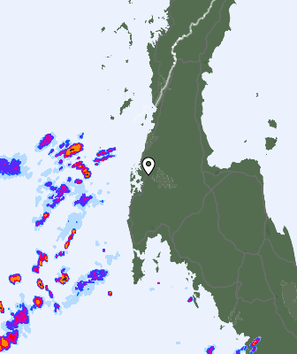 Radar