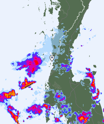 Radar
