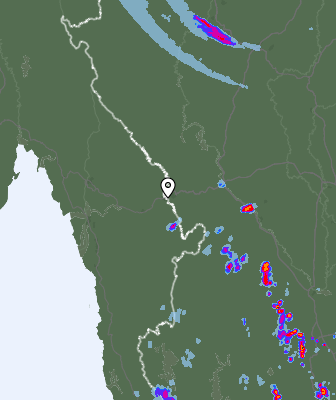 Radar