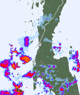Radar