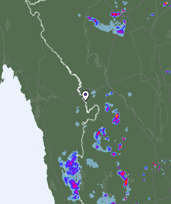 Radar