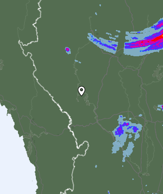 Radar