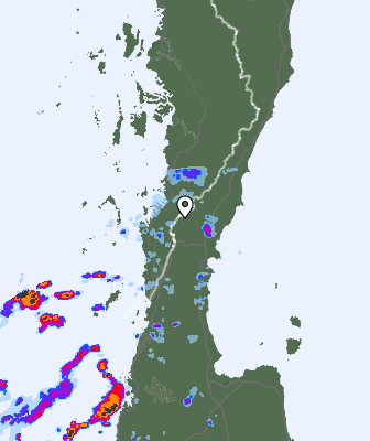 Radar
