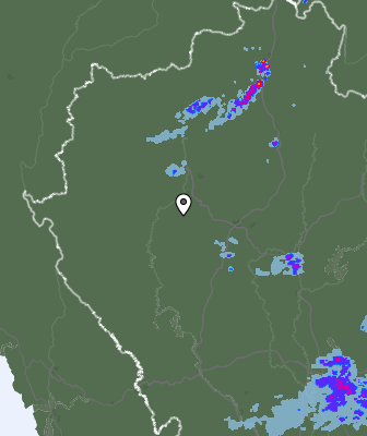 Radar