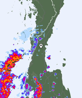 Radar
