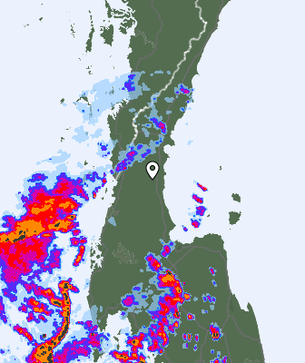 Radar