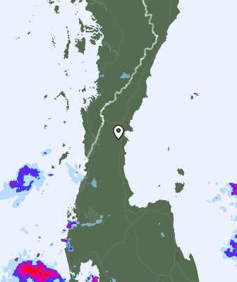 Radar