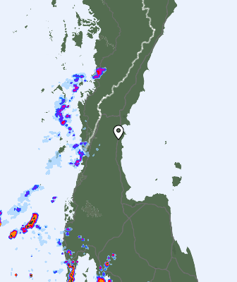 Radar