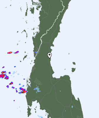 Radar