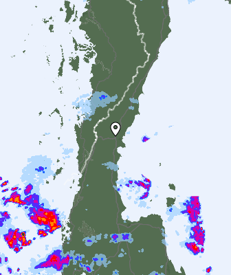 Radar