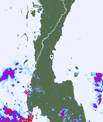 Radar