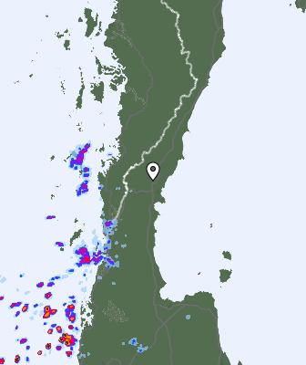 Radar