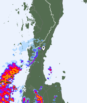 Radar