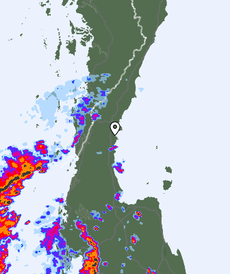 Radar
