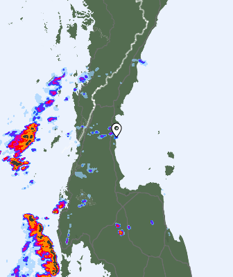 Radar