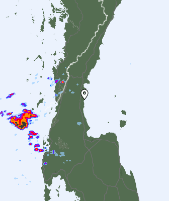 Radar