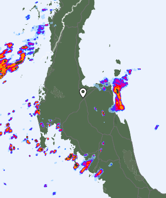 Radar