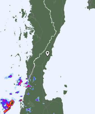 Radar