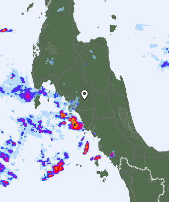 Radar
