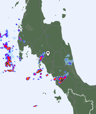 Radar