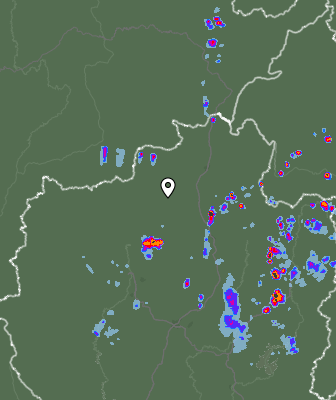 Radar