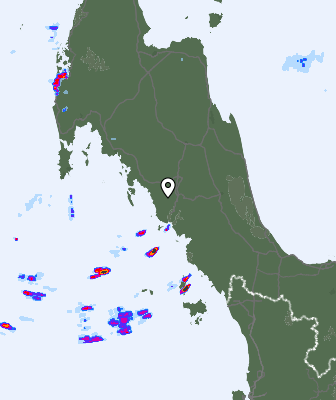 Radar