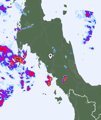 Radar
