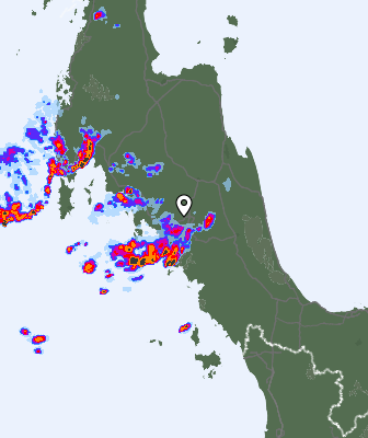 Radar
