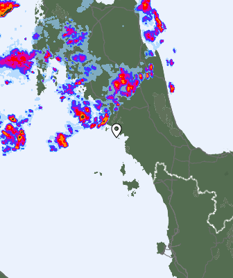 Radar