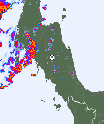 Radar