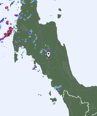 Radar