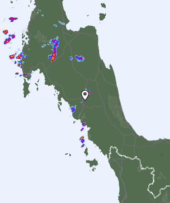Radar