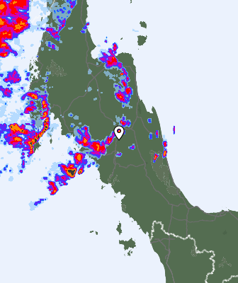 Radar