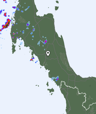 Radar