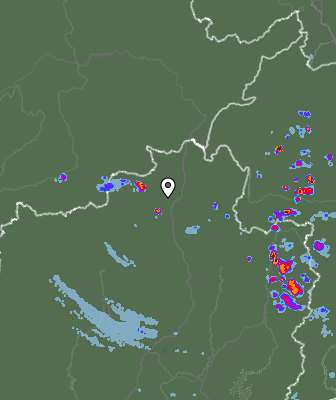 Radar
