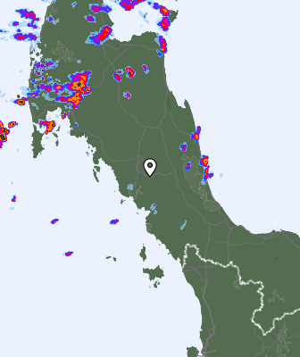 Radar