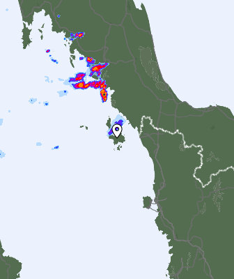 Radar