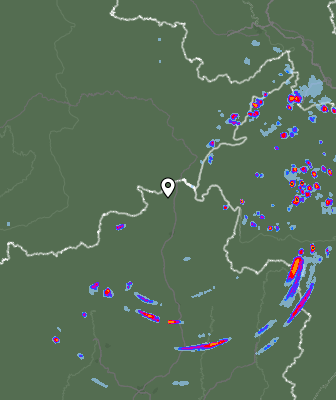 Radar
