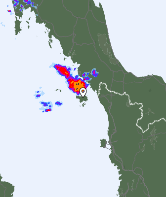 Radar