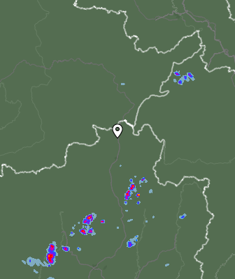 Radar