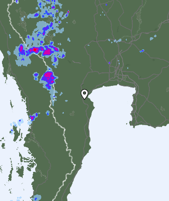 Radar