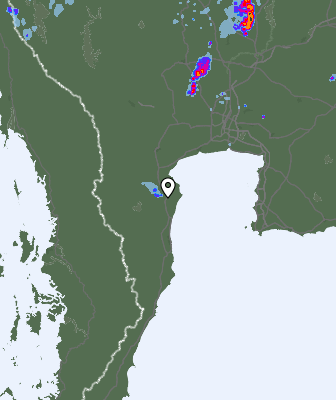 Radar