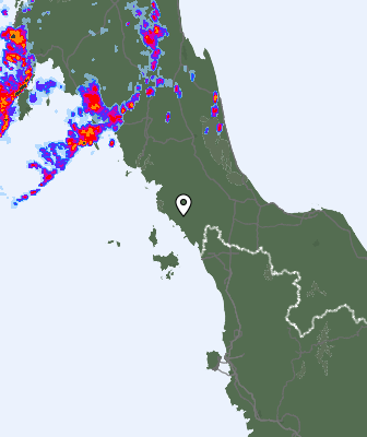 Radar
