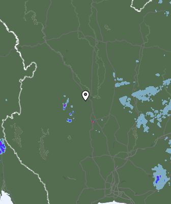 Radar